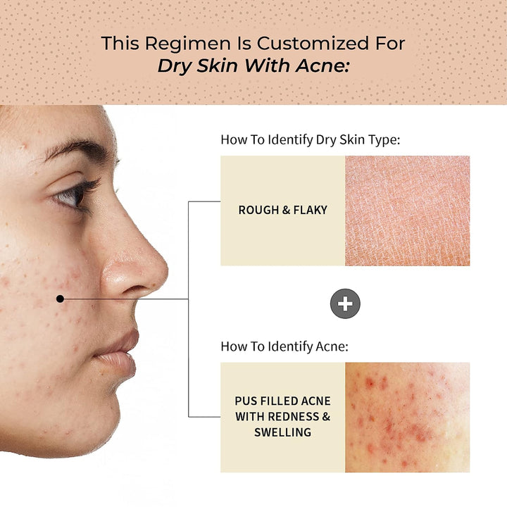 Acne Skin Care Regimen For Dry Skin