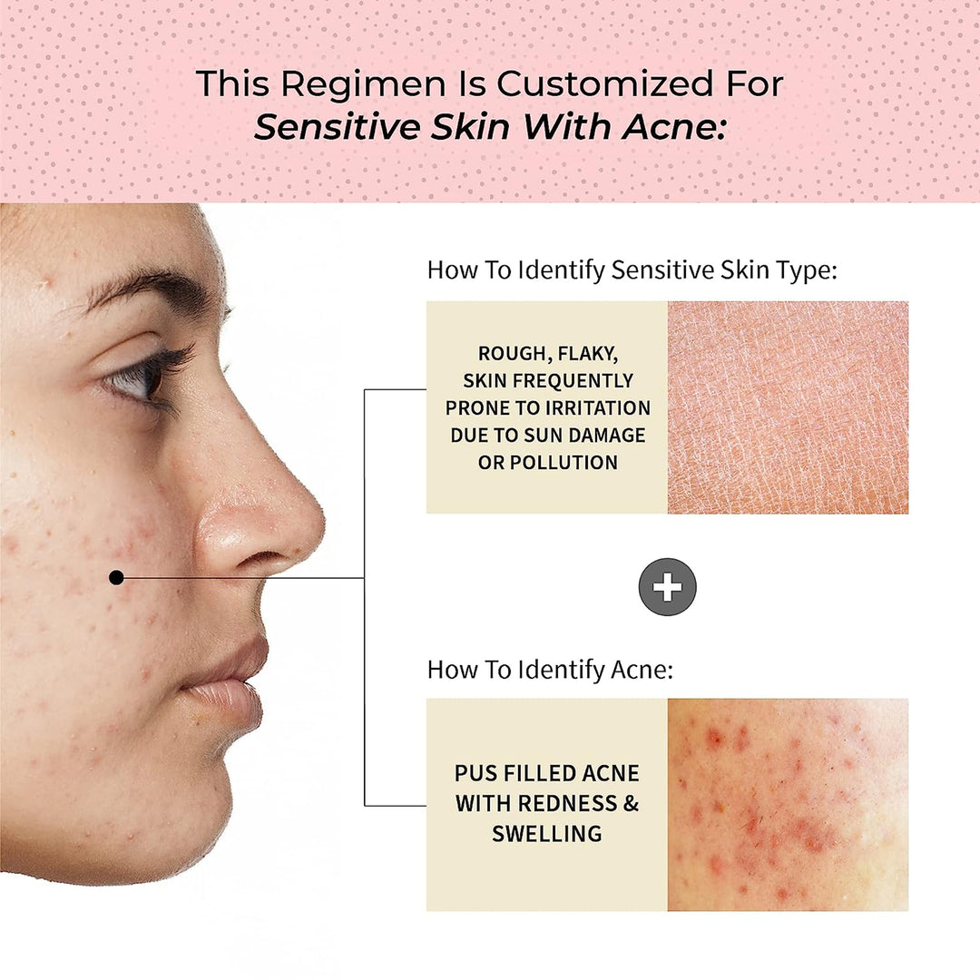 Acne Skin Care Regimen For Sensitive Skin