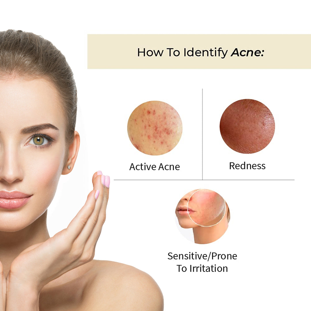 Avas Spot Correcting Face Serum For Anti-Acne 30ml